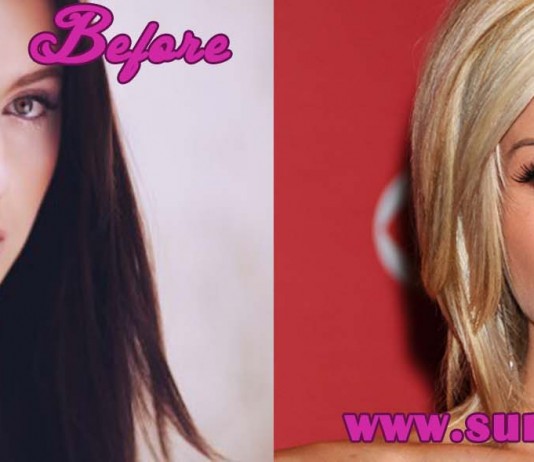 kellie pickler plastic surgery