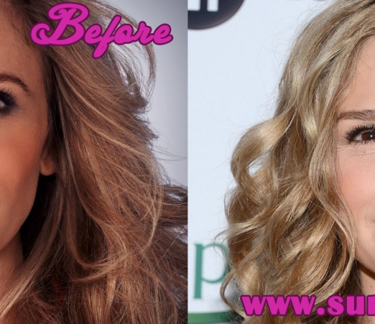 kyra sedgwick plastic surgery