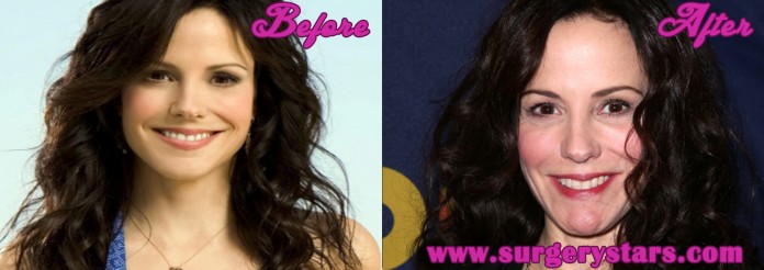 mary louise parker plastic surgery