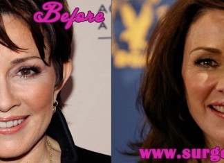 patricia heaton plastic surgery