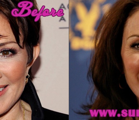 patricia heaton plastic surgery
