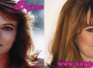 patricia richardson plastic surgery