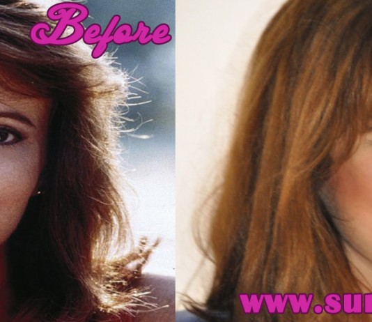 patricia richardson plastic surgery