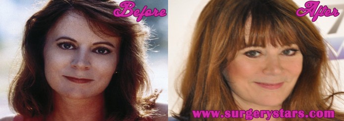 patricia richardson plastic surgery