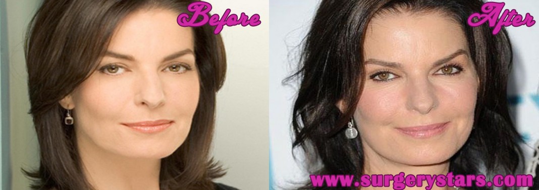 Sela Ward Plastic Surgery - Before and After Shoots