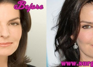 sela ward plastic surgery