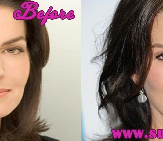 sela ward plastic surgery