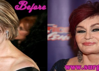 sharon osbourne before plastic surgery