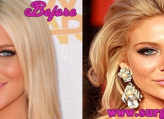 stephanie pratt plastic surgery