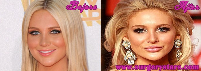 stephanie pratt plastic surgery