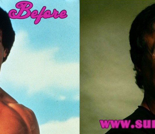 sylvester stallone plastic surgery