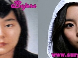 uee plastic surgery