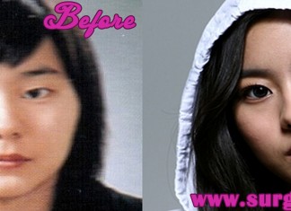 uee plastic surgery