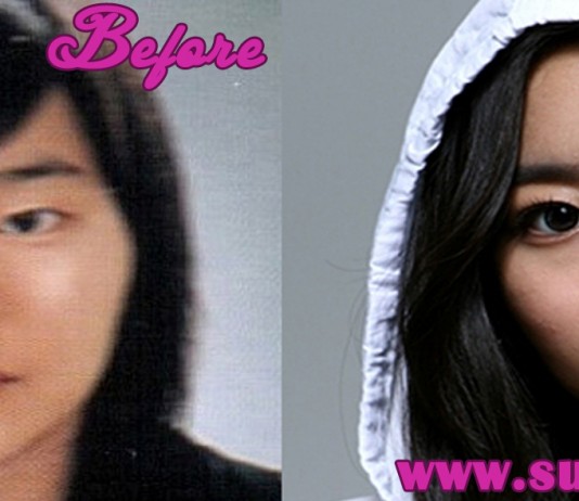 uee plastic surgery