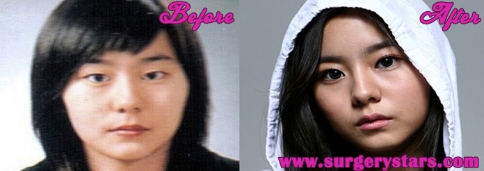 uee plastic surgery