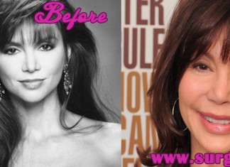 victoria principal plastic surgery