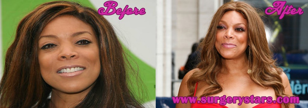 Wendy Williams Plastic Surgery - Before and After Shoots