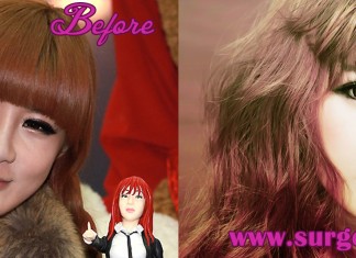 Park Bom Plastic Surgery