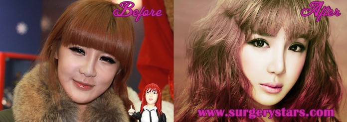 Park Bom Plastic Surgery