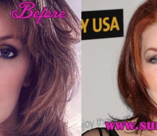 Priscilla Presley Plastic Surgery