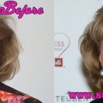 Barbara Walters Plastic Surgery - Before and After Photos