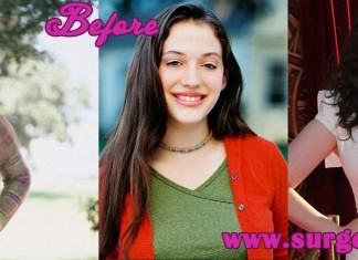 Kat Dennings bra size Plastic Surgery