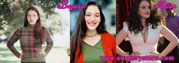 Kat Dennings bra size Plastic Surgery