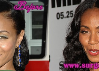 Jada Pinkett Smith Plastic Surgery Before and After Photos