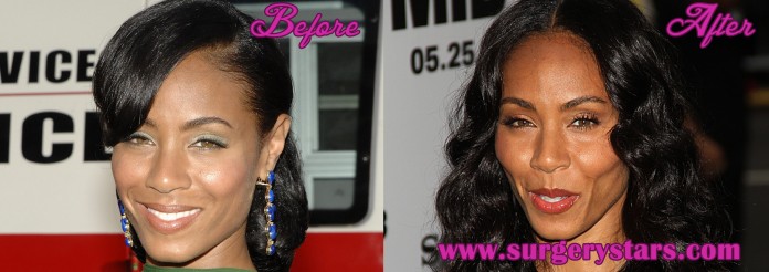 Jada Pinkett Smith Plastic Surgery Before and After Photos