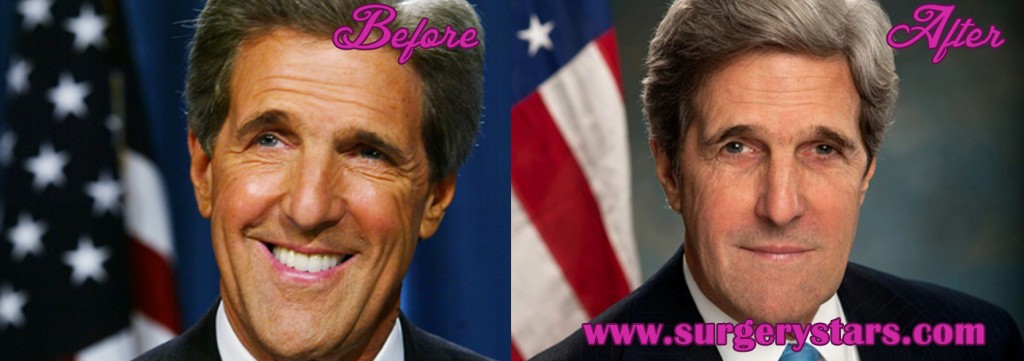 John Kerry Plastic Surgery