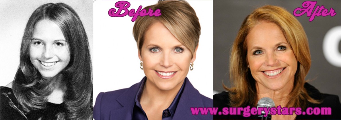 Katie Couric Plastic Surgery Before And After Pictures 3830