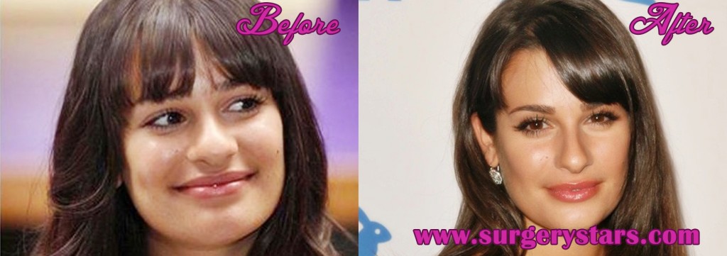 Lea Michelle Plastic Surgery