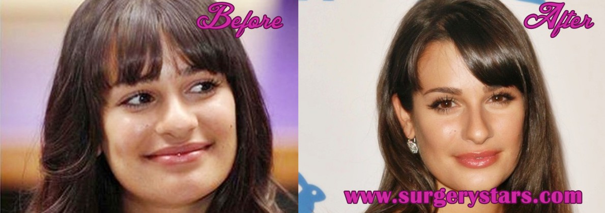 Lea Michelle Plastic Surgery Before And After Photos 