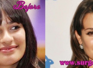 Lea Michelle Plastic Surgery