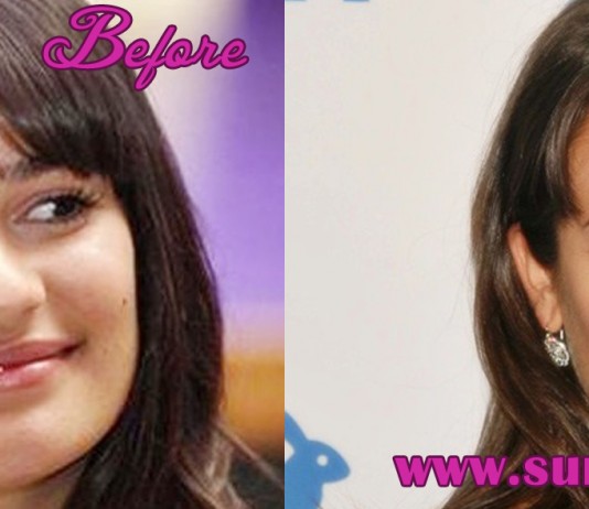 Lea Michelle Plastic Surgery