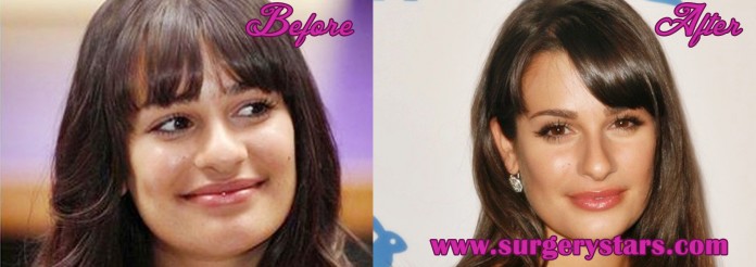 Lea Michelle Plastic Surgery