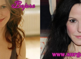 Mary Louise Parker Plastic Surgery