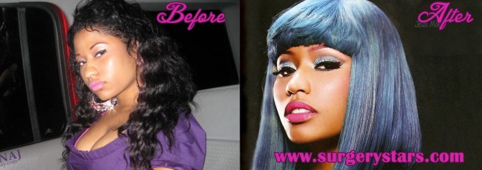 Nicki Minaj Plastic Surgery