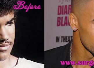 Shemar Moore Plastic Surgery