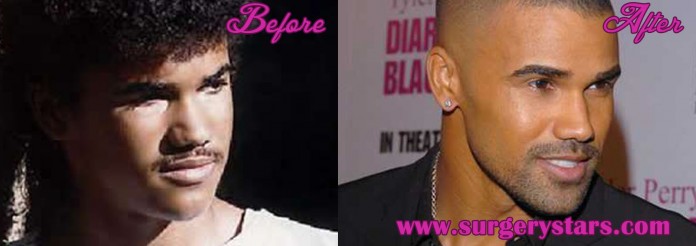 Shemar Moore Plastic Surgery