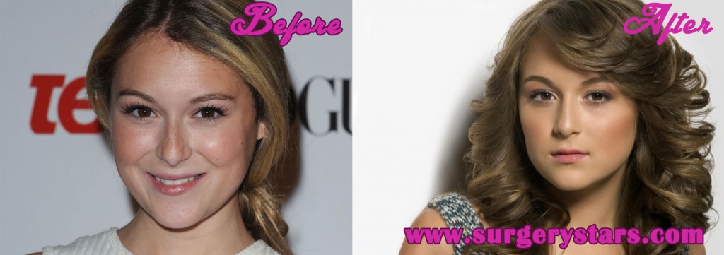 Alexa Vega Plastic Surgery