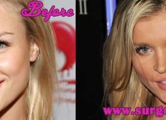 Joanna Krupa Plastic Surgery