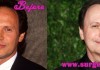 Billy Crystal Plastic Surgery