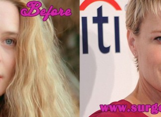 Robin Wright Plastic Surgery