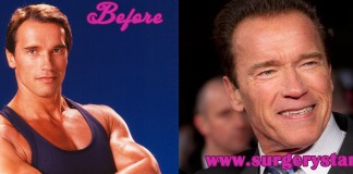 arnold schwarzenegger before and after