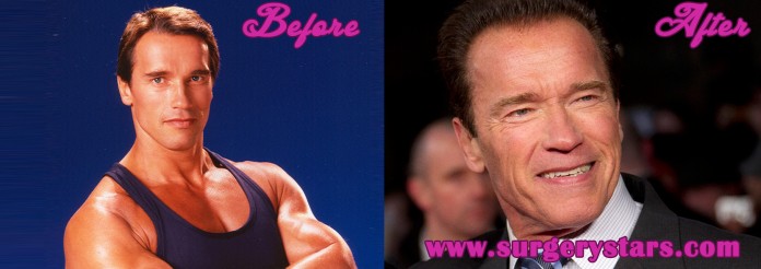arnold schwarzenegger before and after