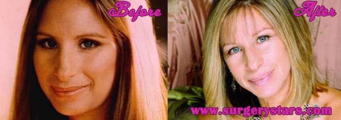 Barbra Streisand Plastic Surgery