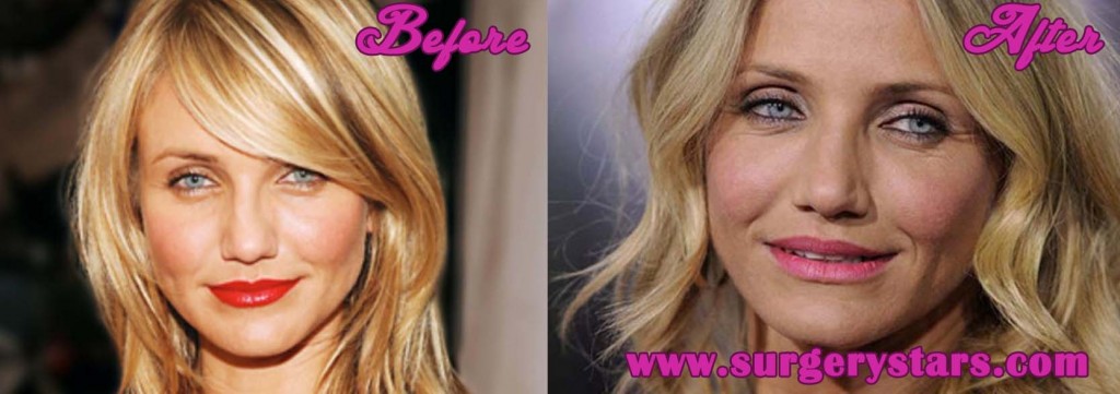 Cameron Diaz Nose Job