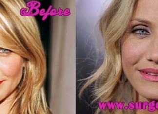 Cameron Diaz Nose Job