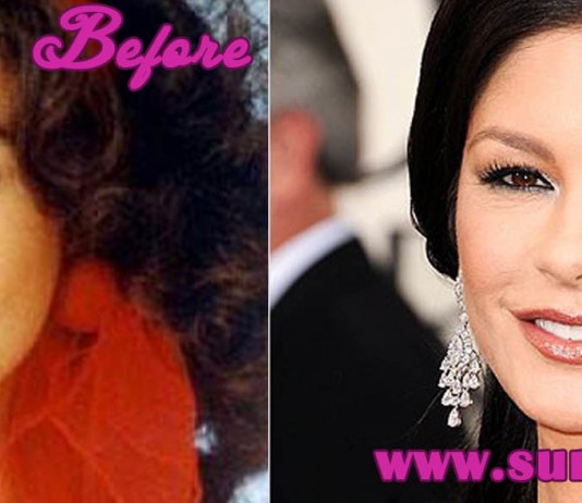 Catherine Zeta Jones Plastic Surgery